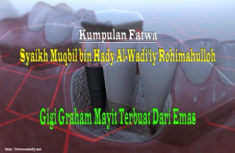 Permasalahan: Gigi Graham Mayit Yang Terbuat Dari Emas Boleh Dicabut atau dikubur bersamanya?