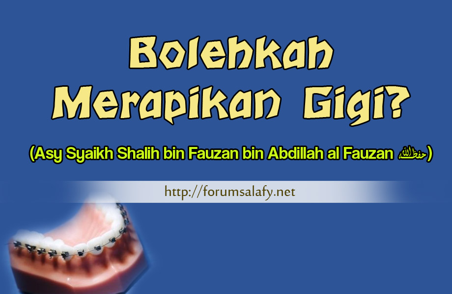 Bolehkah Merapikan Gigi?